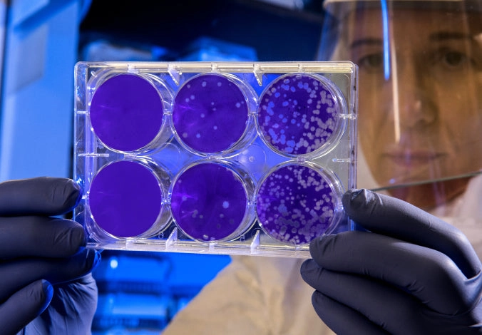 Scientist holding a six-well culture plate up to the light